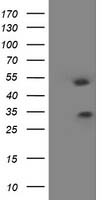 HOXC11 Antibody
