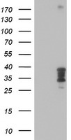 HOXC11 Antibody