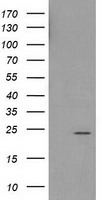 HDHD1A Antibody