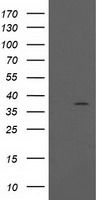 PIH1D2 Antibody