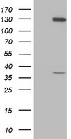 PIH1D2 Antibody
