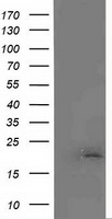 Malignant T cell amplified sequence 1 Antibody