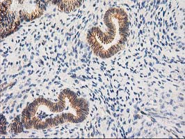 CTNNB1 Antibody