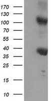 Tristetraprolin Antibody