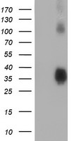 Tristetraprolin Antibody