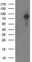 PKC epsilon Antibody