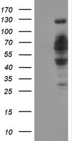 DCLRE1B Antibody