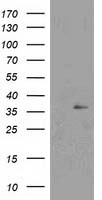 NUDT6 Antibody