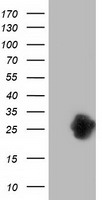 ZFAND2B Antibody