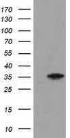 ACY3 Antibody
