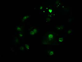 CTDSP1 Antibody