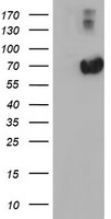 alpha 1 Fetoprotein Antibody