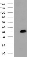 SULT1A1 Antibody