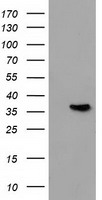 Annexin A3 Antibody
