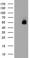 SQSTM1 Antibody