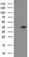 HAO1 Antibody
