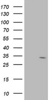 SDR O Antibody