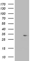 SDR O Antibody