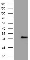 OTUB2 Antibody