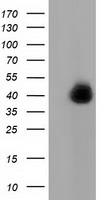 LRATD2 Antibody