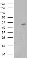 Glutathione Synthetase Antibody