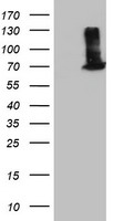 EPM2AIP1 Antibody
