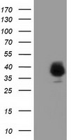 LRATD2 Antibody