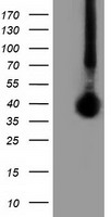 LRATD2 Antibody