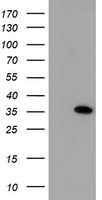 SULT1A1 Antibody