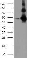 ZIM2 Antibody