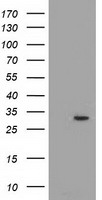PYCR2 Antibody