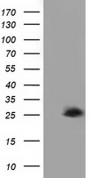 AK3 Antibody
