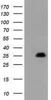 SULT1A1 Antibody