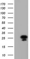 AK3 Antibody