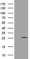 AK3 Antibody