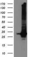 Glutathione S Transferase theta 2 Antibody