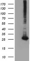 Glutathione S Transferase theta 2 Antibody