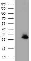 GSTT2 Antibody