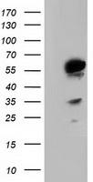 TCP11L2 Antibody