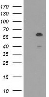 TCP11L2 Antibody