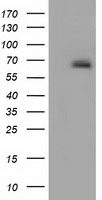 alpha 1 Fetoprotein Antibody