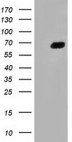 alpha 1 Fetoprotein Antibody