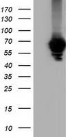 AFP Antibody