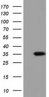 SDR O Antibody