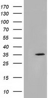SDR O Antibody