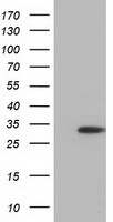 SULT2A1 Antibody