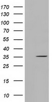 SDR O Antibody