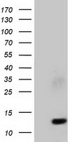 FSH beta Antibody