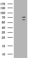 TRIM2 Antibody