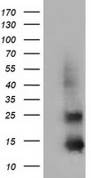 FSH beta Antibody
